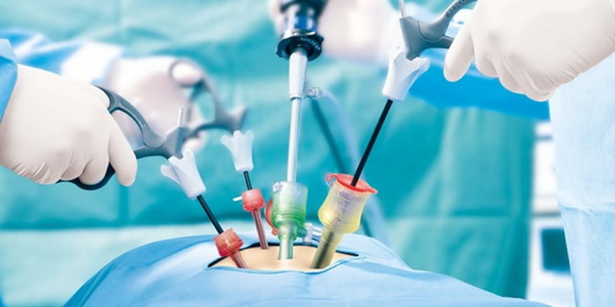 Urology Surgical Devices Market Size, Key Players Analysis, Business Growth, Regional Trend and Forecast by 2031
